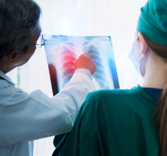 asian doctor team examine x-ray film of patient analysis to find bext solution for operation and treat health ideas concept